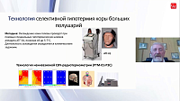 Перспективы применения терапевтической гипотермии у пациентов с поражениями головного мозга 